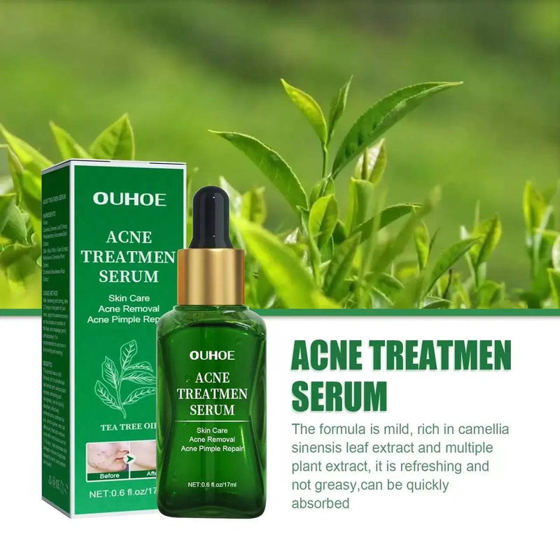 Sérum facial anti-acne