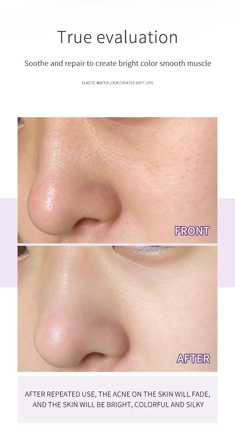 Máscara Facial Anti-Acne